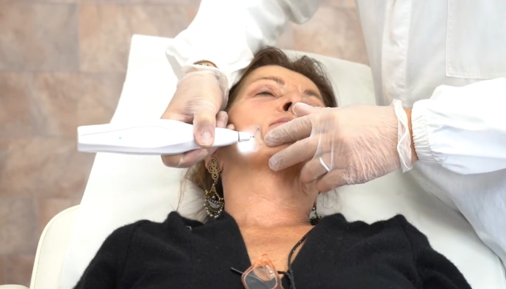 Peeling Fisico PLEXR